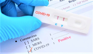 Businesses required to report prices of COVID-19 testing kits